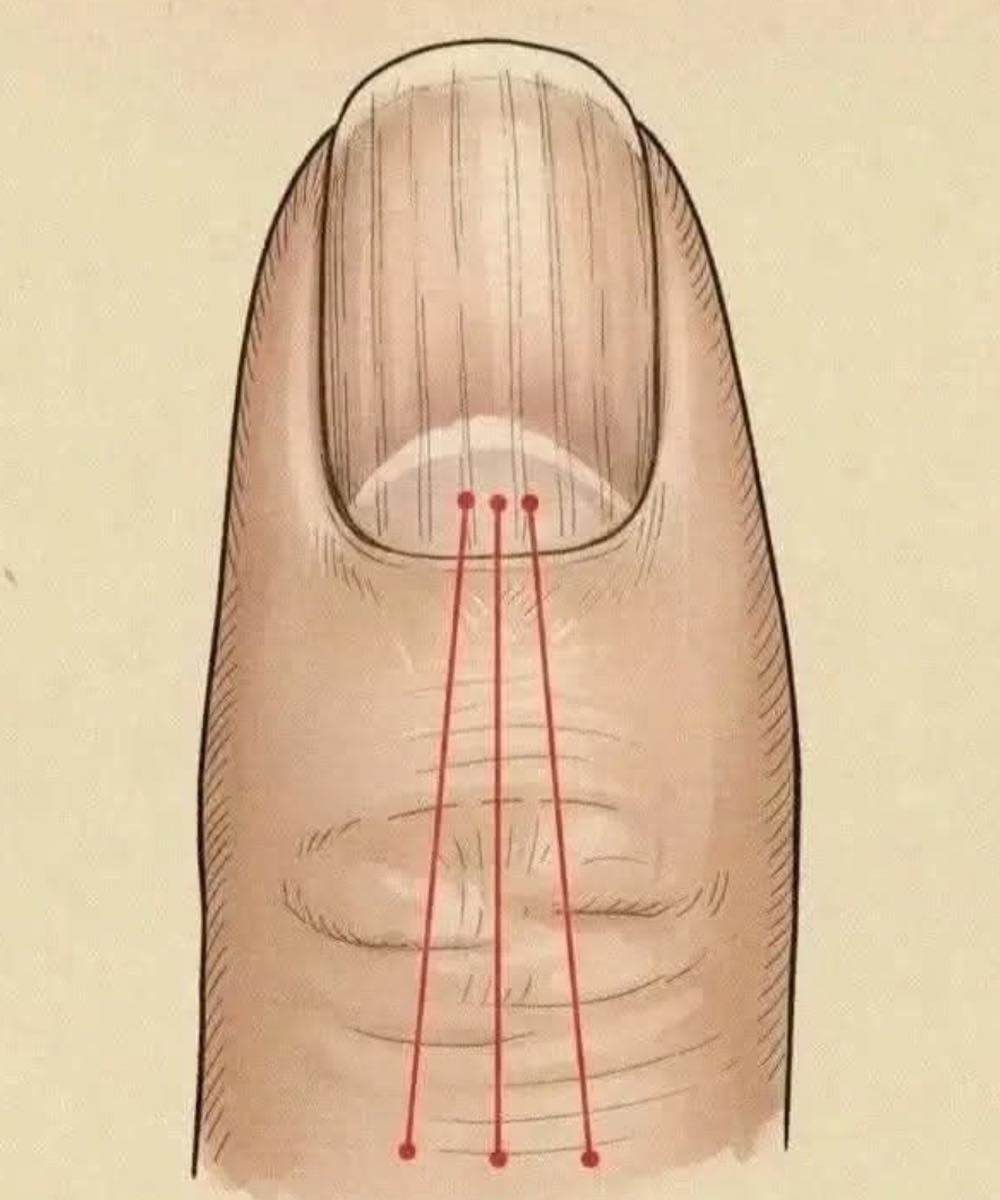 If you have these lines on your nails after 40, it is a clear sign that..