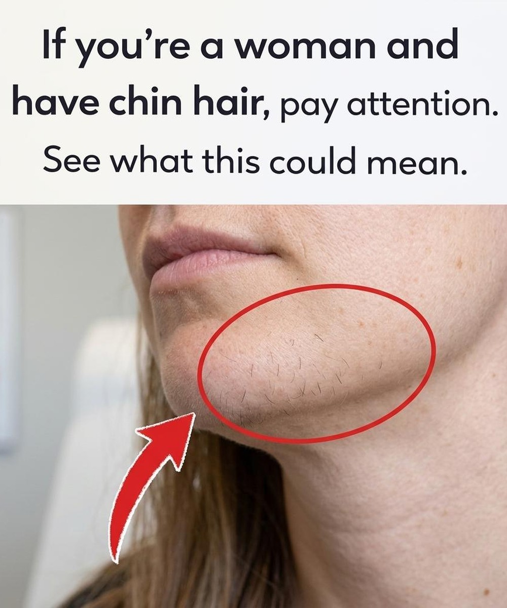 Understanding Facial Hair in Women: Causes, Changes, and Care Options