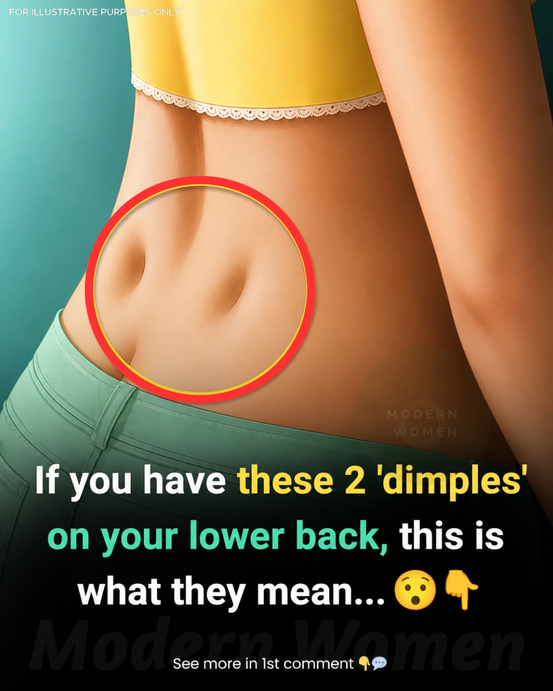 Venus Dimples Explained: The Science Behind These Rare Lower-Back Indentations