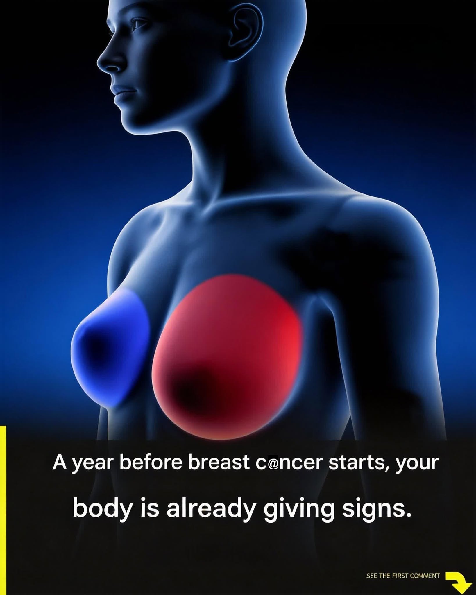 Breast ċãnċêr: 4 Early Warning Signs Every Woman Shouldn’t Ignore