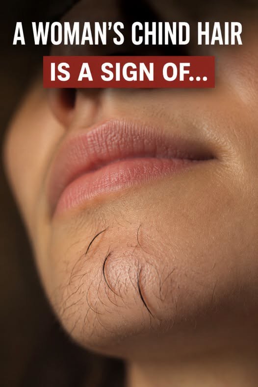 Why Some Women Develop Chin Hair and What It Could Mean